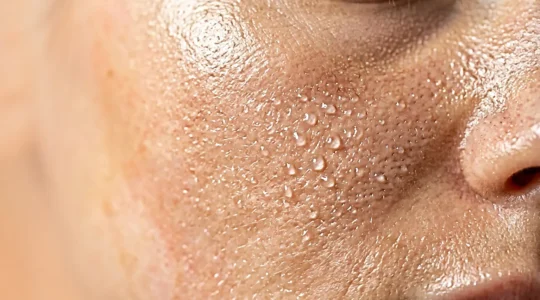 Close-up of healthy, hydrated skin showing moisture droplets and smooth texture without any visible blemishes