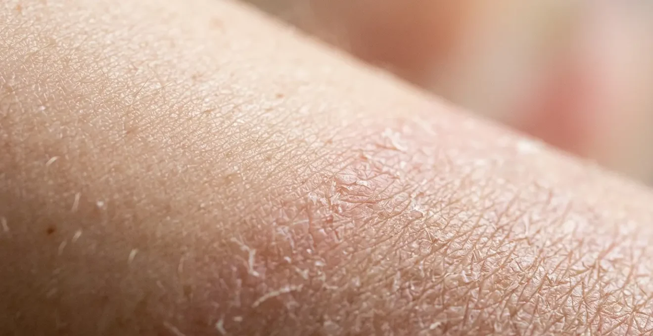 Close-up of healthy skin texture showing the healing process of skin barrier repair after over-exfoliation